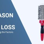 5 REASONS FOR HAIR LOSS